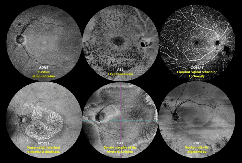 Winner from the FLORetina 2026 Congress